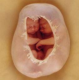 孕期的这些胎梦据说是宝宝的报恩方式，看看你做过哪种胎梦？